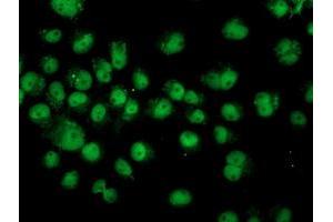 Anti-ASCC1 mouse monoclonal antibody (ABIN2455148) immunofluorescent staining of COS7 cells transiently transfected by pCMV6-ENTRY ASCC1 (RC201872). (ASCC1 抗体)