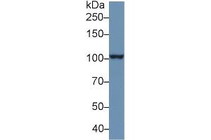 Western Blot; Sample: Human PANC1 cell lysate; Primary Ab: 1µg/ml Rabbit Anti-Human PSA Antibody Second Ab: 0.