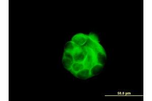 Immunofluorescence of monoclonal antibody to SGCB on MCF-7 cell. (SGCB 抗体  (AA 87-196))