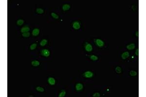 Immunofluorescent analysis of A549 cells using ABIN7156394 at dilution of 1:100 and Alexa Fluor 488-congugated AffiniPure Goat Anti-Rabbit IgG(H+L) (INTS1 抗体  (AA 451-710))
