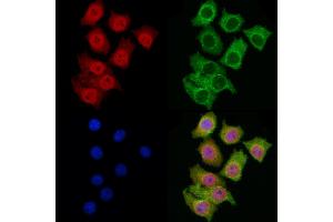 ABIN6266253 and ABIN6277443 staining HepG2 cells by IF/ICC. (MYSM1 抗体  (Internal Region))