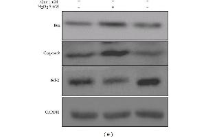 Effects of quercetin on cell apoptosis in H2O2-treated H9C2 cells. (Caspase 9 抗体)
