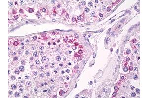Anti-USP13 antibody IHC of human testis. (USP13 抗体  (AA 500-550))