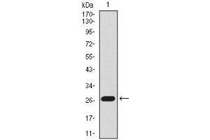 Western blot analysis using Lplunc1 mAb against mouse Lplunc1 recombinant protein. (BPIFB1 抗体  (AA 248-475))