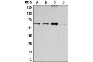 Western blot analysis of Cyclin B1 expression in Jurkat (A), K562 (B), HEK293T (C), HeLa (D) whole cell lysates. (Cyclin B1 抗体  (Center))