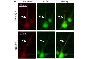 Cultured rat hippocampal neurons (DIV 11-12) were treated for 48 h with 1 μM TTX or its vehicle control (0.