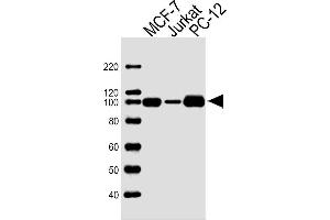Lane 1: MCF-7 Cell lysates, Lane 2: Sample Tissue/Cell lysates, Lane 3: PC-12 Cell lysates, probed with TOP1 (1291CT875. (Topoisomerase I 抗体)