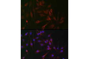 Immunofluorescence analysis of C6 cells using IL6ST antibody (ABIN7268003) at dilution of 1:100. (CD130/gp130 抗体  (AA 678-857))