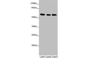 Western blot All lanes: PRPF4 antibody at 2. (PRPF4 抗体  (AA 1-260))