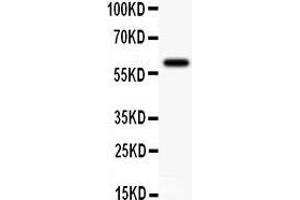 Western Blotting (WB) image for anti-Potassium Intermediate/small Conductance Calcium-Activated Channel, Subfamily N, Member 4 (KCNN4) (AA 14-29), (N-Term) antibody (ABIN3043233)