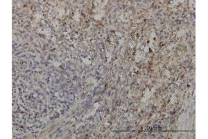 Image no. 2 for anti-GRB2-Related Adaptor Protein 2 (GRAP2) (AA 226-316) antibody (ABIN599077) (GRAP2 抗体  (AA 226-316))