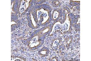 IHC analysis of EIF3A using anti-EIF3A antibody (ABIN7599942). (EIF3A 抗体  (AA 13-477))
