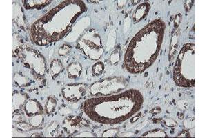 Image no. 12 for anti-SKI-Like Oncogene (SKIL) (AA 307-684) antibody (ABIN1491380) (SKIL 抗体  (AA 307-684))
