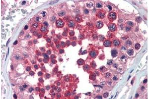 Human Testis (formalin-fixed, paraffin-embedded) stained with FHL1 antibody ABIN462171 followed by biotinylated goat anti-rabbit IgG secondary antibody ABIN481713, alkaline phosphatase-streptavidin and chromogen. (FHL1 抗体  (AA 51-100))