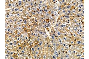 ABIN7094337 and ABIN7098384 at 1/100 staining mouse liver tissue by IHC-P.