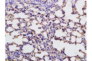 Formalin-fixed and paraffin embedded rat lung tissue labeled with Anti-FBP1 Polyclonal Antibody, unconjugated (ABIN752053) at 1:200 followed by incubation with conjugated secondary antibody
