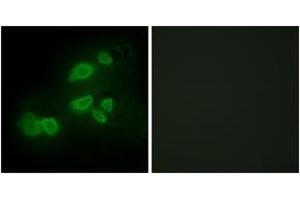 Immunofluorescence analysis of HepG2 cells, using CDCP1 Antibody.