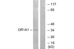 Western blot analysis of extracts from COLO cells, using OR1A1 antibody. (OR1A1 抗体  (C-Term))