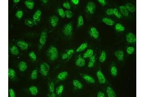 IF analysis of CTBP1 using anti-CTBP1 antibody (ABIN3043816).
