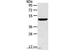Western blot analysis of Mouse liver tissue, using TM7SF2 Polyclonal Antibody at dilution of 1:400 (TM7SF2 抗体)