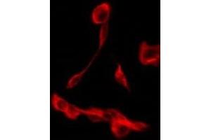 ABIN6275268 staining JK by IF/ICC.