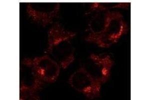 Anti-Rabl Ab at 1/1,000 däution, 293HEK transfectcd tysate at SO µg per Iane, Rabbit polycJonal to goat lµg (HRP) at 1/10,000 dilution. (RAB1A 抗体  (C-Term))