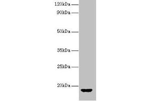 Western blot All lanes: AVP antibody at 2 μg/mL + Rat gonadal tissue Secondary Goat polyclonal to rabbit IgG at 1/10000 dilution Predicted band size: 18 kDa Observed band size: 18 kDa (Vasopressin 抗体  (AA 126-164))