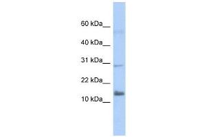 FAM14A antibody used at 1 ug/ml to detect target protein. (IFI27L2 抗体  (Middle Region))