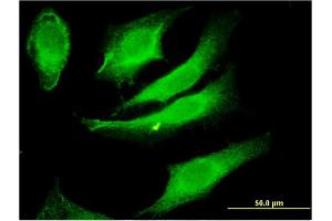 Immunofluorescence of monoclonal antibody to PACSIN2 on HeLa cell.