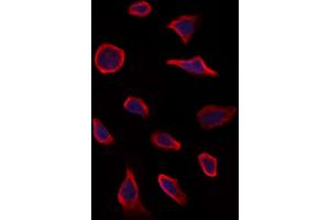 ABIN6263303 and ABIN6273267 staining Hela by IF/ICC.
