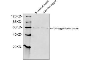 Western blot analysis of Ty1 tagged fusion proteins expressed in E. (Ty1 Tag 抗体)