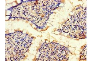 Immunohistochemistry of paraffin-embedded human small intestine tissue using ABIN7145600 at dilution of 1:100 (BLOC1S1 抗体  (AA 1-153))