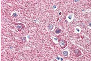 Human Brain, Cortex (formalin-fixed, paraffin-embedded) stained with HK1 antibody ABIN364333 at 5 ug/ml followed by biotinylated anti-mouse IgG secondary antibody ABIN481714, alkaline phosphatase-streptavidin and chromogen.