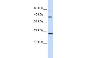 WB Suggested Anti-CHRAC1 Antibody Titration:  0. (CHRAC1 抗体  (N-Term))