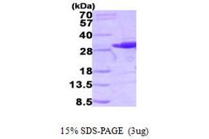 SDS-PAGE (SDS) image for V-Ral Simian Leukemia Viral Oncogene Homolog B (Ras Related, GTP Binding Protein) (Ralb) (AA 1-203) protein (His tag) (ABIN667855)