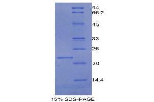 SDS-PAGE (SDS) image for Protein C Receptor, Endothelial (PROCR) (AA 59-217) protein (His tag) (ABIN1980605)