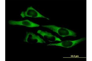 Immunofluorescence of purified MaxPab antibody to QARS on HeLa cell. (QARS 抗体  (AA 1-775))