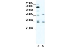 WB Suggested Anti-ZNF488 Antibody Titration:  1. (ZNF488 抗体  (C-Term))