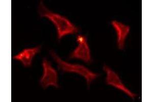 ABIN6275798 staining Hela by IF/ICC. (Cyclin M2 抗体  (Internal Region))