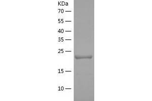 Western Blotting (WB) image for Proteasome (Prosome, Macropain) Activator Subunit 2 (PA28 Beta) (PSME2) (AA 2-239) protein (His tag) (ABIN7289368) (PSME2 Protein (AA 2-239) (His tag))