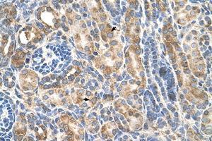 Image no. 1 for anti-P-Cadherin (CDH3) (AA 187-236) antibody (ABIN205074) (P-Cadherin 抗体  (AA 187-236))
