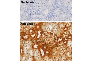 Immunohistochemistry (IHC) image for anti-Protein Disulfide Isomerase Family A, Member 3 (PDIA3) (C-Term) antibody (ABIN1440038) (PDIA3 抗体  (C-Term))