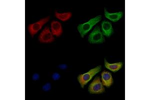 CD1a Antibody staining Hela cells by IF/ICC.
