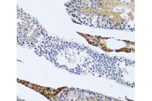 Immunohistochemistry of paraffin-embedded Rat testis using FMOD Polyclonal Antibody at dilution of 1:100 (20x lens). (Fibromodulin 抗体)