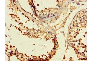 Immunohistochemistry of paraffin-embedded human testis tissue using ABIN7151860 at dilution of 1:100 (EPH Receptor B2 抗体  (AA 261-465))