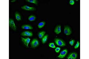 Immunofluorescent analysis of A549 cells using ABIN7174020 at dilution of 1:100 and Alexa Fluor 488-congugated AffiniPure Goat Anti-Rabbit IgG(H+L) (Fgr 抗体  (AA 11-72))