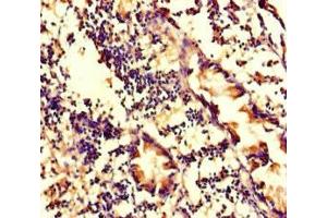 Immunohistochemistry of paraffin-embedded human appendix tissue using ABIN7175714 at dilution of 1:100 (WDFY4 抗体  (AA 1-322))