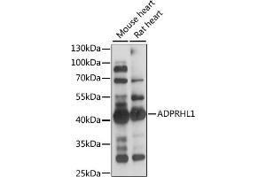 Western blot analysis of extracts of various cell lines, using  antibody (ABIN7265500) at 1:1000 dilution. (ADPRHL1 抗体  (AA 80-280))