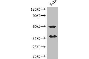 Western Blot Positive WB detected in: Hela whole cell lysate All lanes: AKR1B1 antibody at 3 μg/mL Secondary Goat polyclonal to rabbit IgG at 1/50000 dilution Predicted band size: 36 kDa Observed band size: 36, 50 kDa (AKR1B1 抗体  (AA 114-230))