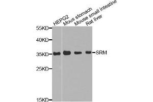 Western blot analysis of extract of various cells, using SRM antibody. (Spermidine Synthase 抗体)